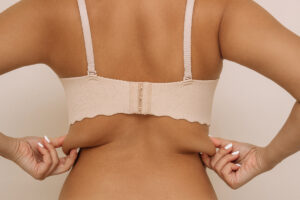 breast fat grafting