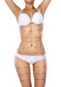 liposuction in Korea body contouring breast fat grafting