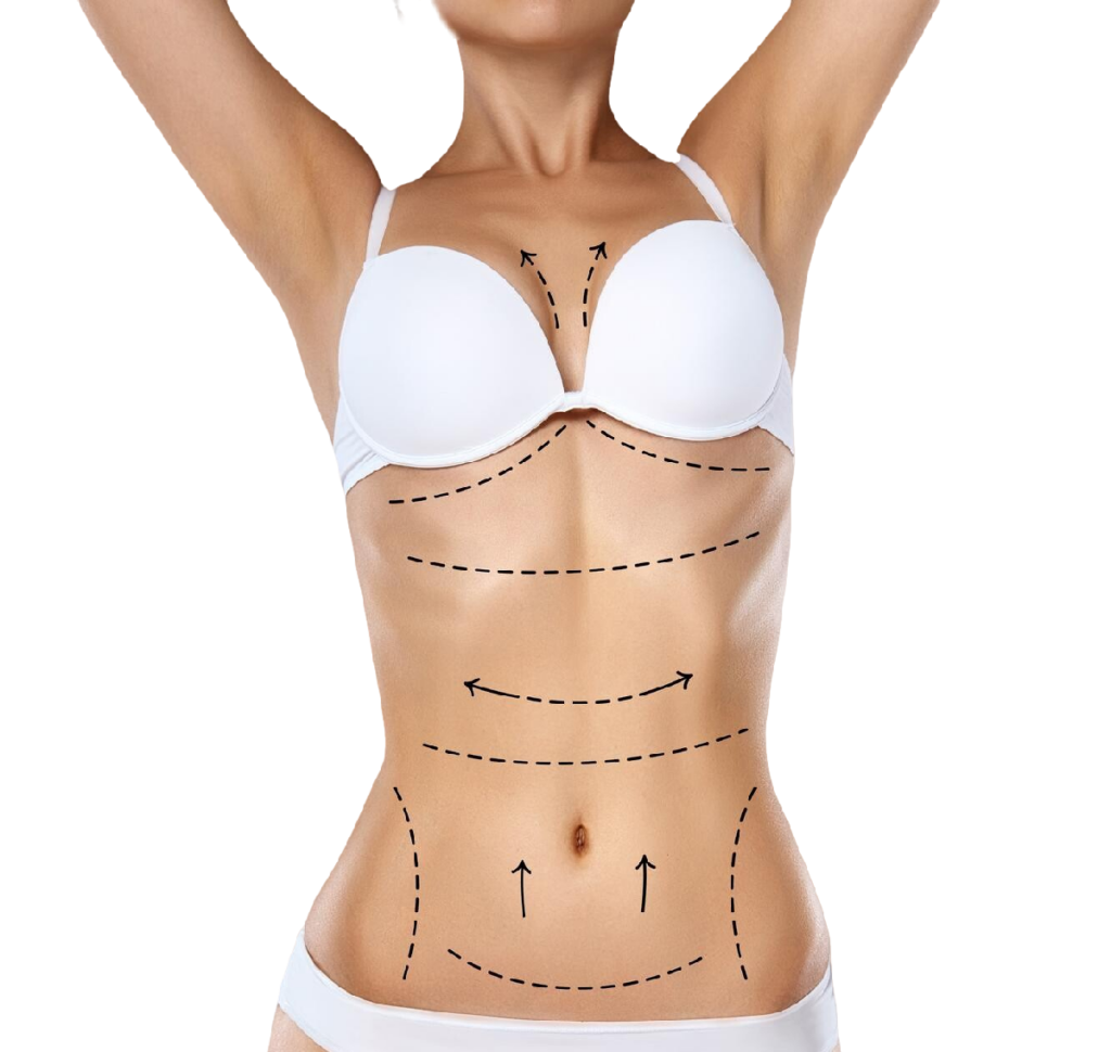 liposuction in Korea body contouring breast fat grafting
