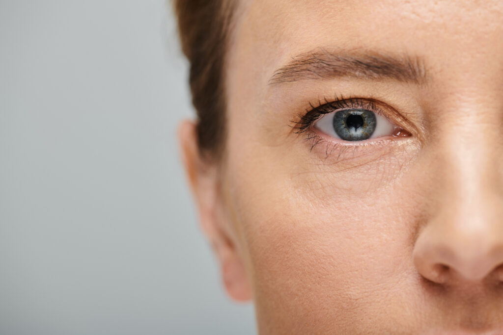Close-up of a patient's smooth tear trough and periorbital area showcasing natural results from under-eye fat grafting in Korea.